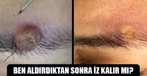 ben aldırma sonrası